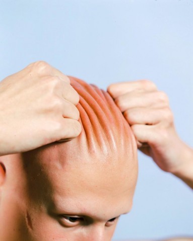 Guille-sofria-bullying-por-ter-Alopécia