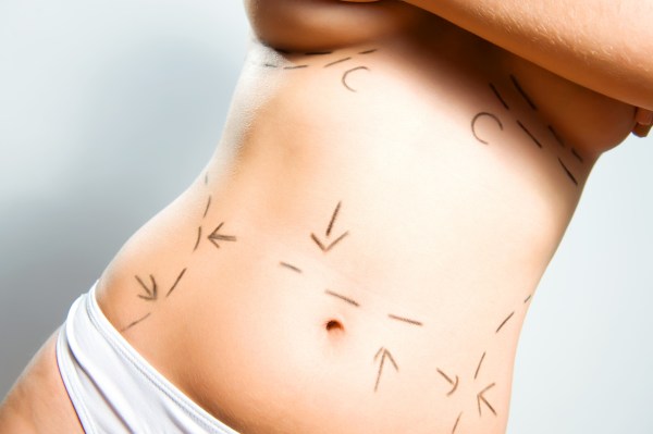 Breast augmentation and abdominal cosmetic surgeries