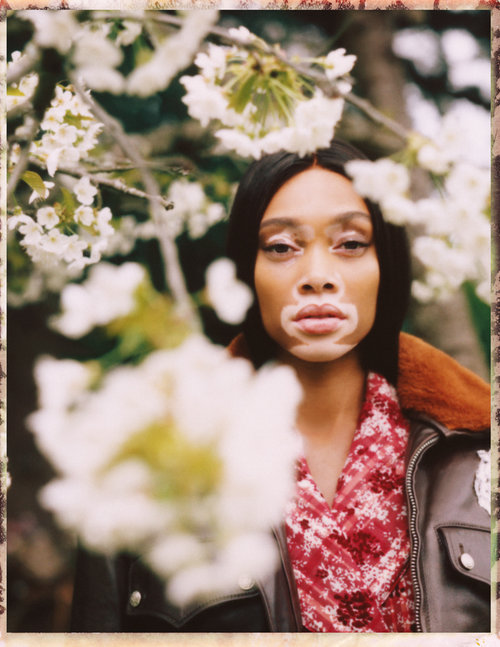 Winnie+Harlow+by+Emily+Soto+Vogue+UA